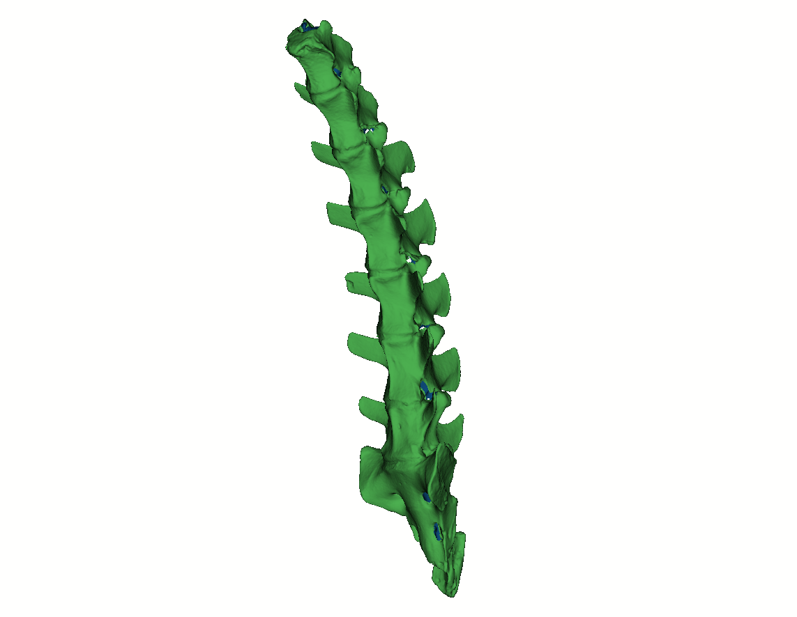 A 3D-scan of a spine by Calibry