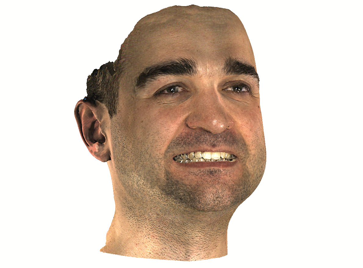 A 3D-scan of a face with a smile by Calibry 3D-scanner